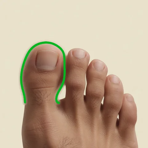 toe